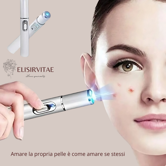 DEFELIA®  Laser Penn- Penna rimuovi imperfezioni