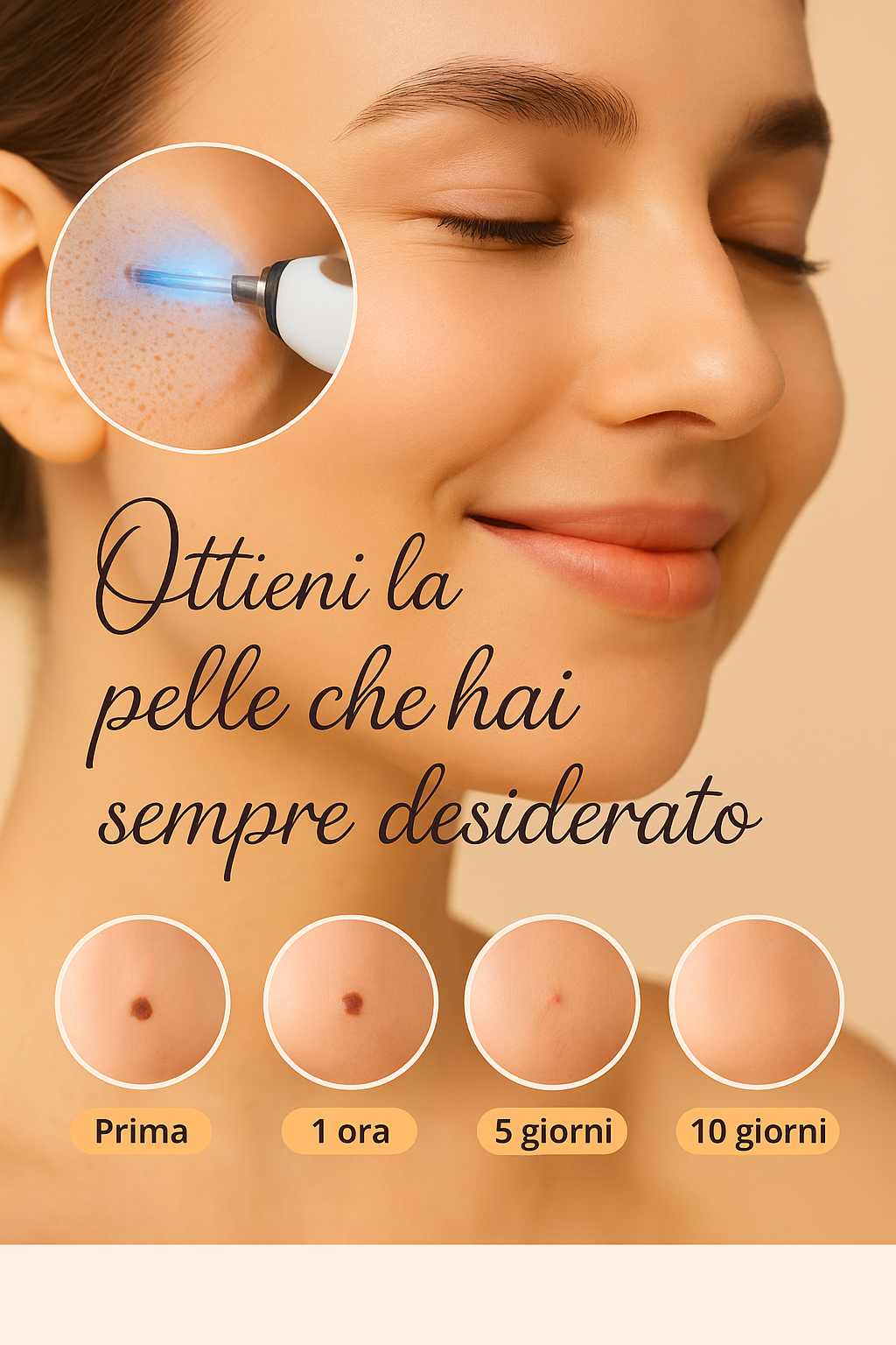 Penna Laser al Plasma con luce UV