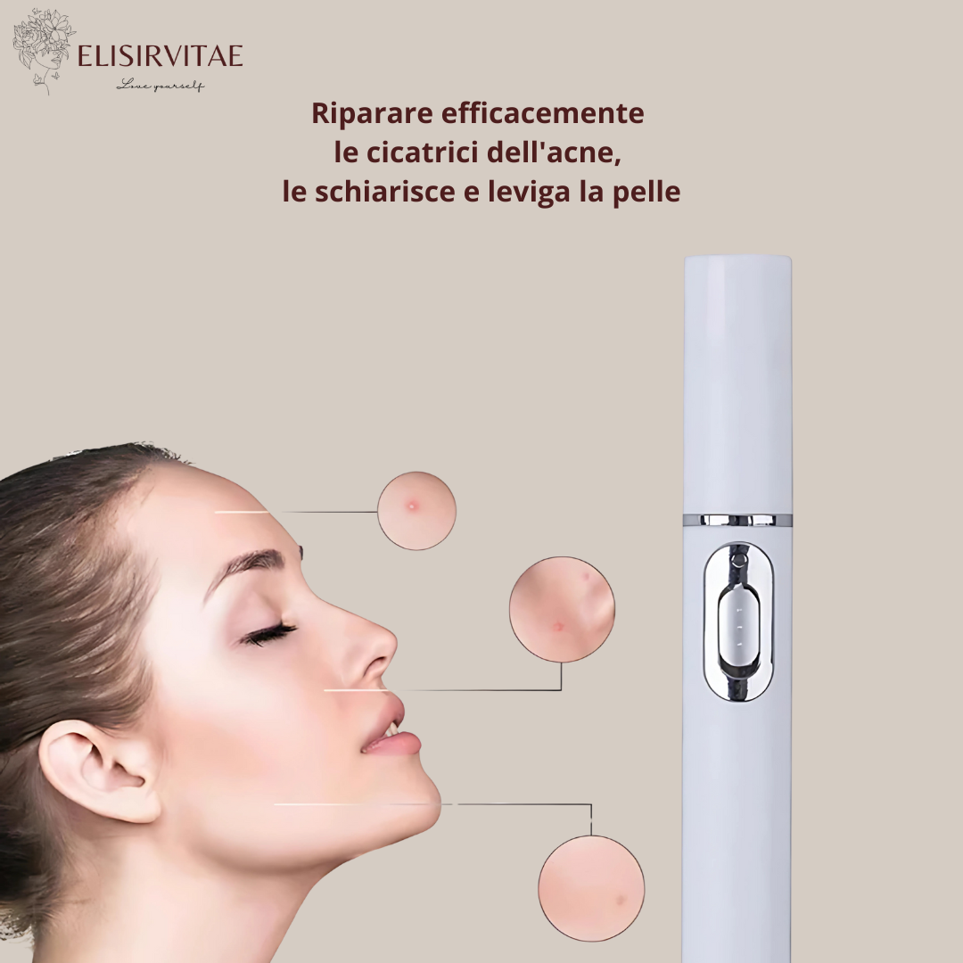 DEFELIA®  Laser Penn- Penna rimuovi imperfezioni